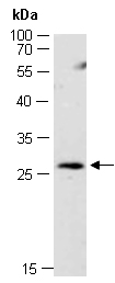 NKIRAS2 Antibody Western (Abiocode)