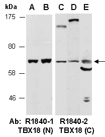 TBX18 Antibody Western (Abiocode)