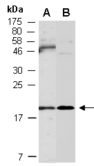 CFL2 Antibody Western (Abiocode)