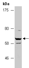 FOXN3 Antibody Western (Abiocode)