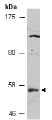 ZDHHC1 Antibody Western (Abiocode)