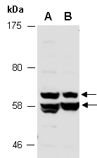 ALDH2 Antibody Western (Abiocode)