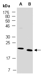 GYPC Antibody Western (Abiocode)