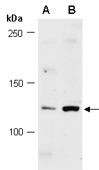 SMC6 Antibody Western (Abiocode)