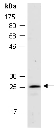 NKX2-8 Antibody Western (Abiocode)