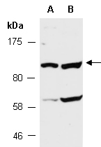 PLD1 Antibody Western (Abiocode)