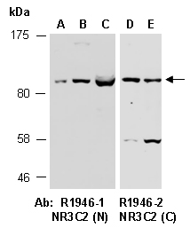 NR3C2 Antibody Western (Abiocode)