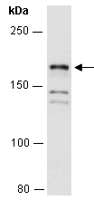 ROBO2 Antibody Western (Abiocode)