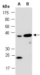 SOX17 Antibody Western (Abiocode)