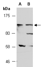 MAPK8IP1 Antibody Western (Abiocode)