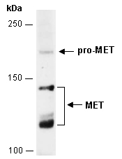 MET Antibody Western (Abiocode)