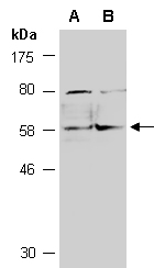 TNFRSF10B Antibody Western (Abiocode)