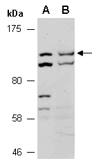 APAF1 Antibody Western (Abiocode)