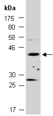 HOXA5 Antibody Western (Abiocode)