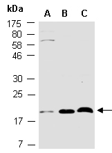 PAIP2B Antibody Western (Abiocode)