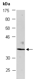 EDA2R Antibody Western (Abiocode)