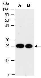 HMGB2 Antibody Western (Abiocode)