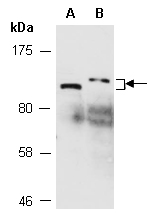 SIRT1 Antibody Western (Abiocode)