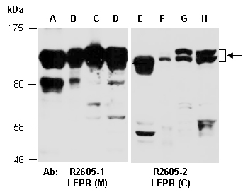 LEPR Antibody Western (Abiocode)