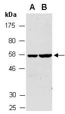 ELK1 Antibody Western (Abiocode)