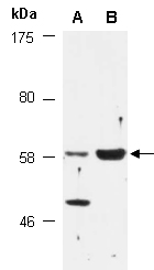 DKC1 Antibody Western (Abiocode)