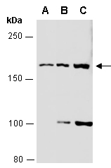 MAP3K4 Antibody Western (Abiocode)