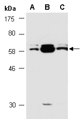 ESRRG Antibody Western (Abiocode)