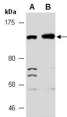 PER1 Antibody Western (Abiocode)