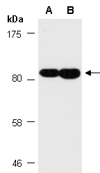 ZDHHC5 Antibody Western (Abiocode)