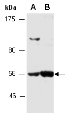 TBX22 Antibody Western (Abiocode)