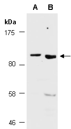 NFATC1 Antibody Western (Abiocode)