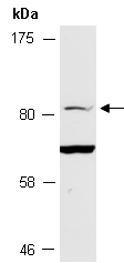 TBK1 Antibody Western (Abiocode)