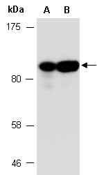 CEACAM5 Antibody Western (Abiocode)