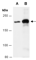 DOCK5 Antibody Western (Abiocode)