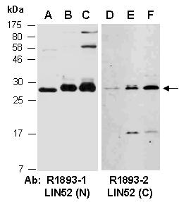 LIN52 Antibody Western (Abiocode)