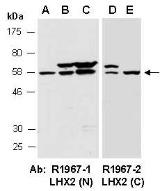 LHX2 Antibody Western (Abiocode)