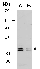 DUSP12 Antibody Western (Abiocode)