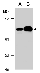 ZC3H12B Antibody Western (Abiocode)