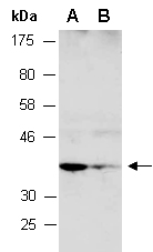 ANXA4 Antibody Western (Abiocode)