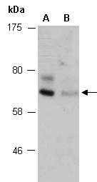 SMYD1 Antibody Western (Abiocode)
