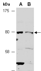MAP3K7 Antibody Western (Abiocode)