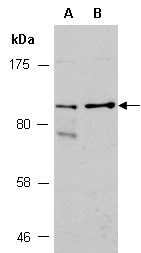 FUT4 Antibody Western (Abiocode)