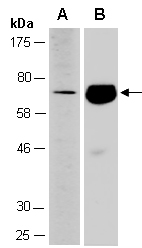 NTNG2 Western Antibody (ABiocode)