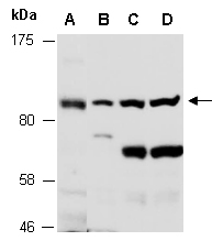 UNC5B Western Antibody (Abiocode)