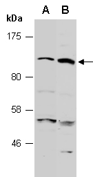 PHF8 Antibody Western (Abiocode)