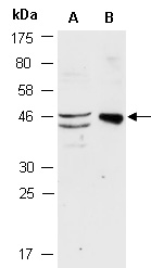 MYOD1 Antibody Western (Abiocode)