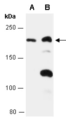 PTCH1 Antibody Western (Abiocode)