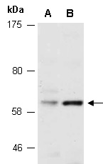 PXN Antibody Western (Abiocode)