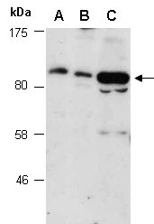 COMP Antibody Western (Abiocode)