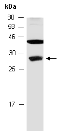 COMMD5 Antibody Western (Abiocode)